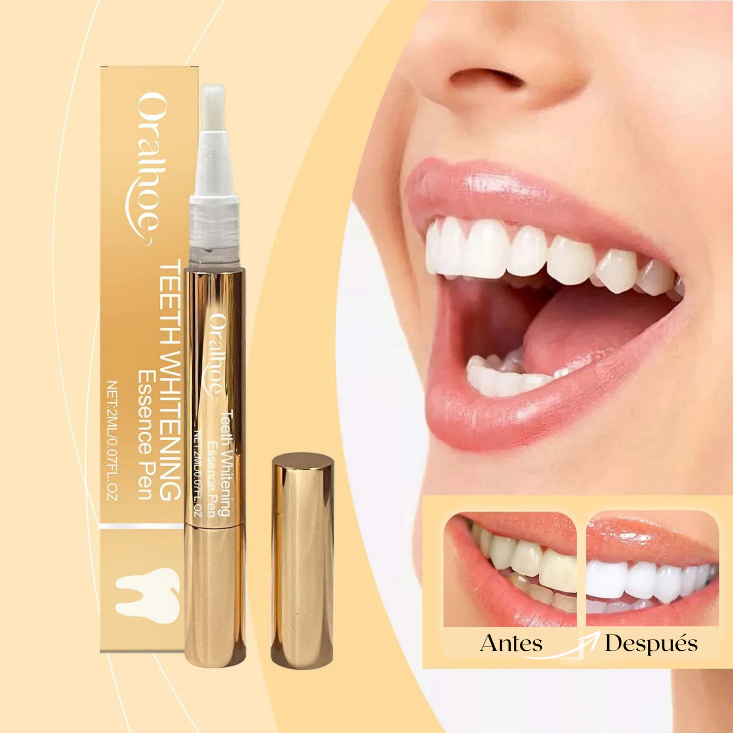 Blanqueamiento Dental Oralhoe