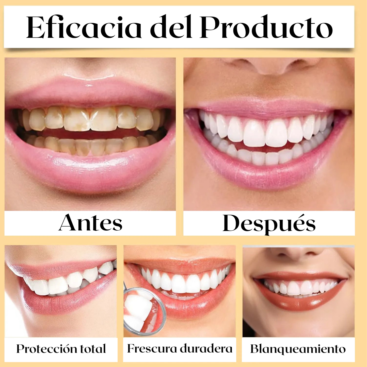 Blanqueamiento Dental Oralhoe